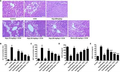 Hyperoside Protected Against Oxidative Stress-Induced Liver Injury via the PHLPP2-AKT-GSK-3β Signaling Pathway In Vivo and In Vitro